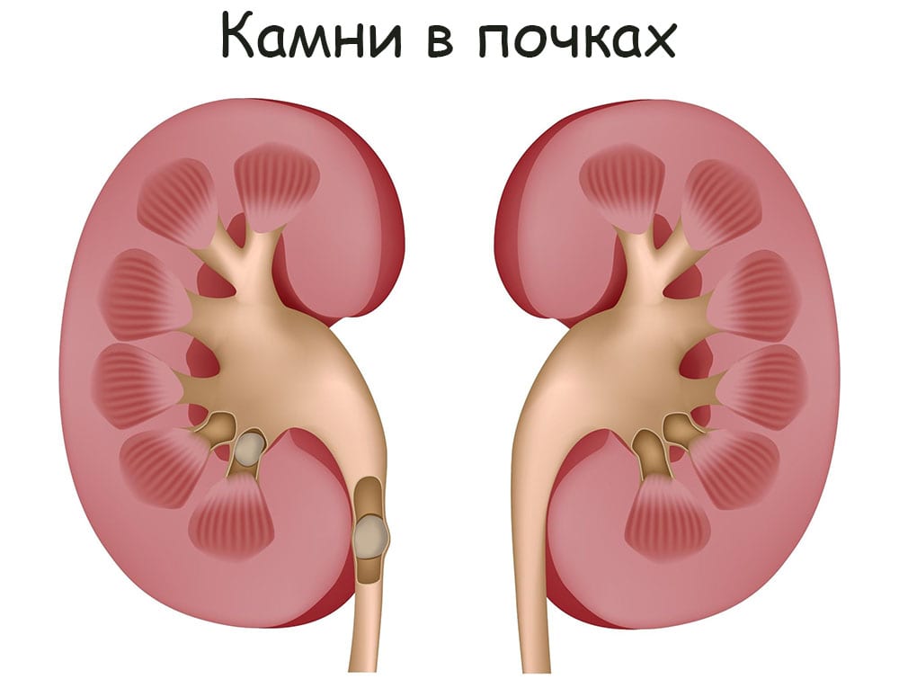 Магазины с наркотиками
